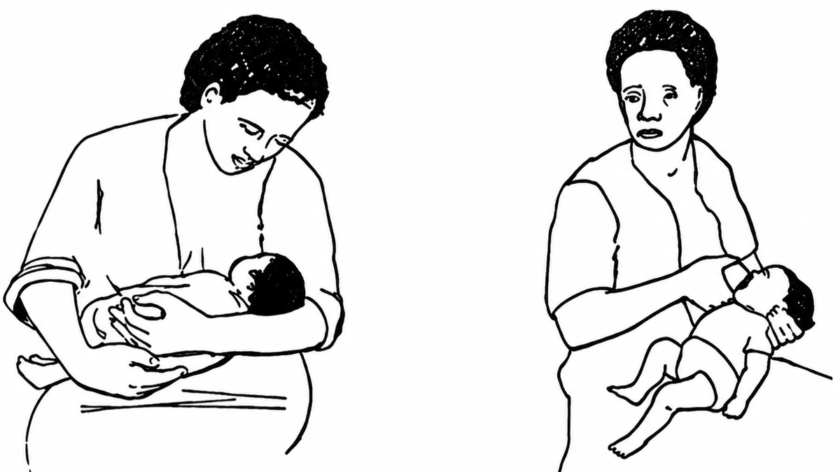 So sánh hai tư thế bú đúng (trên) và sai, cho thấy sự khác nhau khi lượng sữa tiết ra