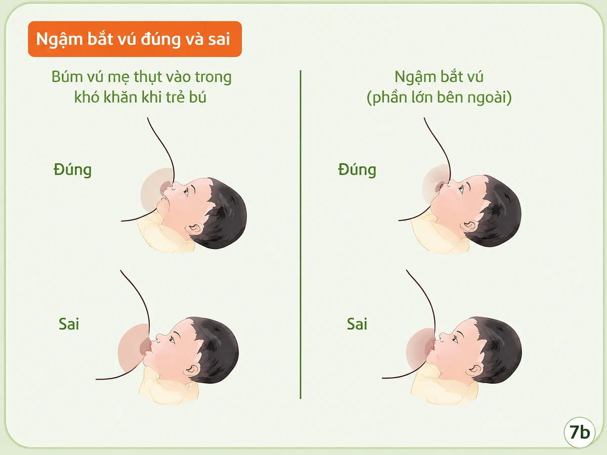 Bé ngậm bắt núm vú đúng